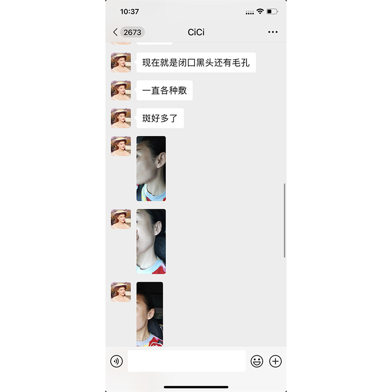 淡斑提亮案例