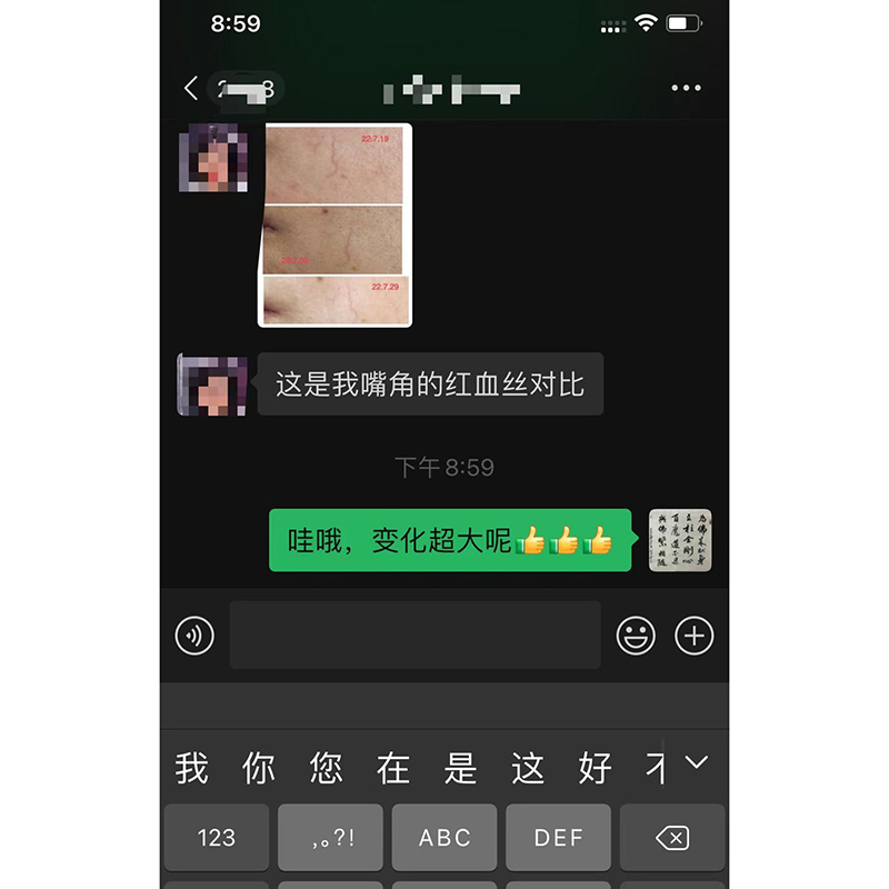 红血丝＋蚊虫叮咬案例