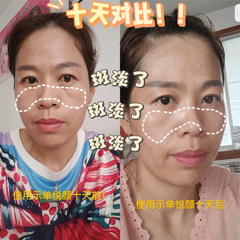 抗衰去皱案例