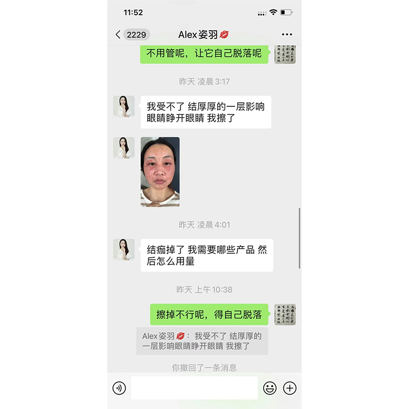 排异案例