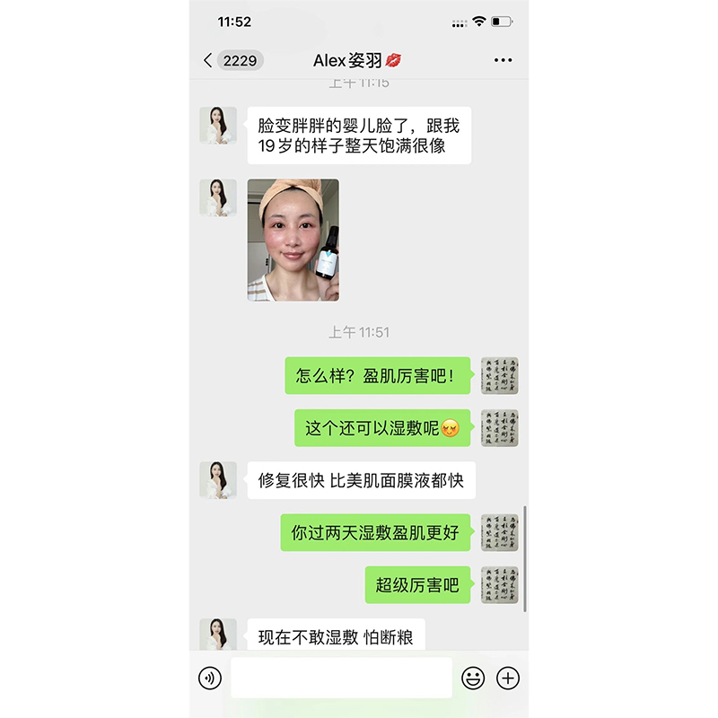排异案例