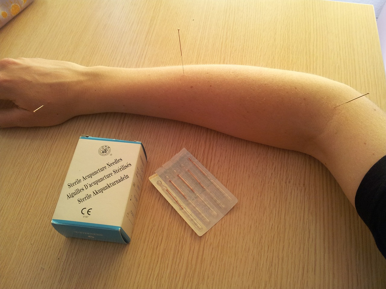 acupuncture-568136_1280